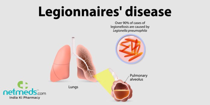 Legionnaires disease australia